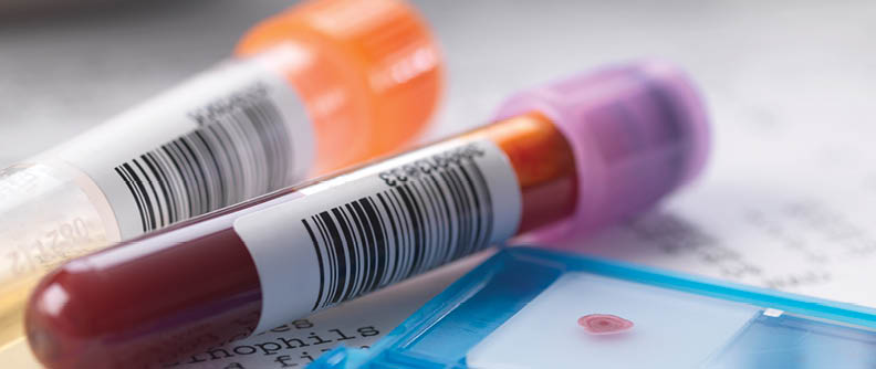 Blood and urine samples with medical results.