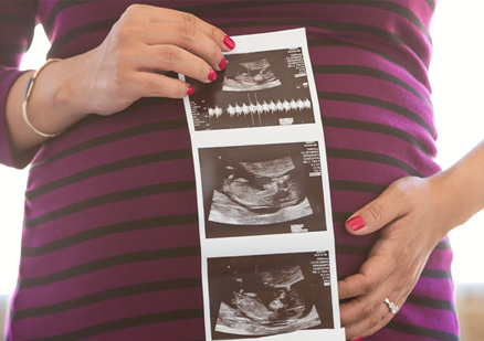 Pregnant woman showing sonogram